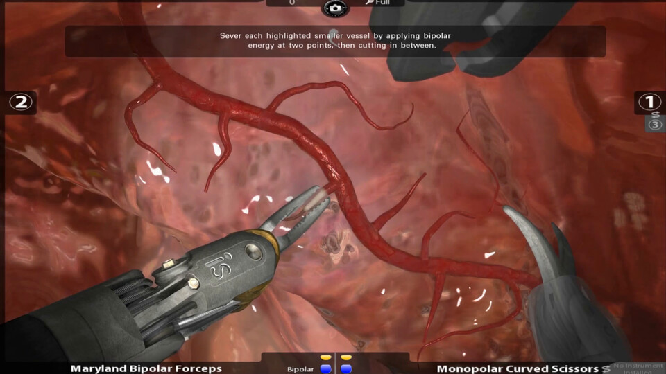 Video: Vessel cauterization