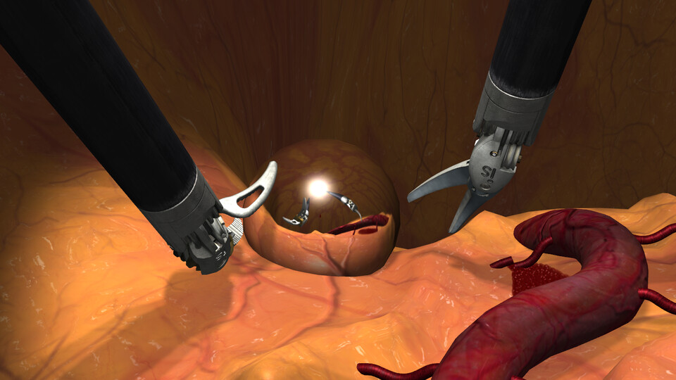 Two instruments reflected in a shiny sphere resting on tissue beside a blood vessel
