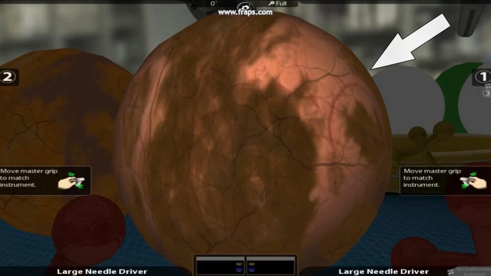 Video: a sphere with a layered tissue shader, an arrow pointing to its lighter, pulsing area