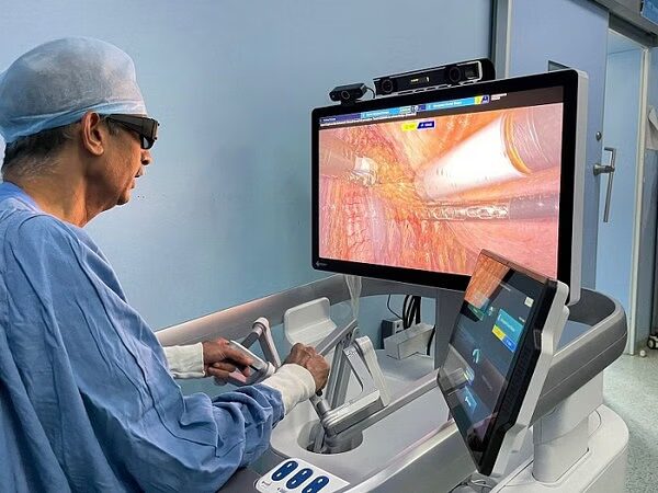 Surgeon wearing 3D glasses at an open robotic surgery console, with a simulated procedure on screen