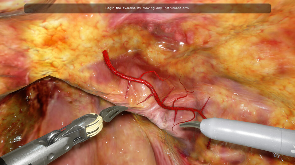 Video: simulated fatty tissue with a branching blood vessel and two robotic instruments