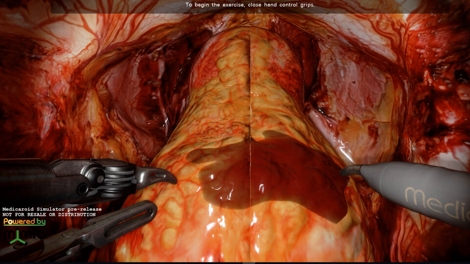 Video: Texture-Space Decals (Blood Rendering)